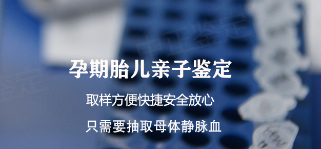 河北孕期亲子鉴定怎么做,河北产前亲子鉴定准确吗